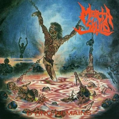 Abbildung von Dying Remains (2cd 30th Anniversary Edition)