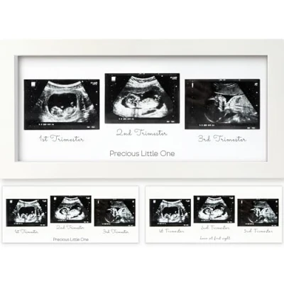 Abbildung von Trio Baby Bilderrahmen für Ultraschallbilder Ultraschallbild Baby, Ultraschall Schwangerschaft, Rahmen, Geschenke Werdende Mamas (Alpine White)