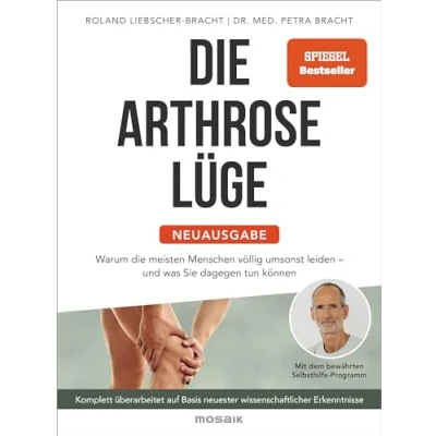 Abbildung von die Arthrose Lüge Neuausgabe: Warum meisten Menschen völlig umsonst leiden und was Sie dagegen tun können Mit dem bewährten ... neuester wissenschaftlicher Erkenntnisse