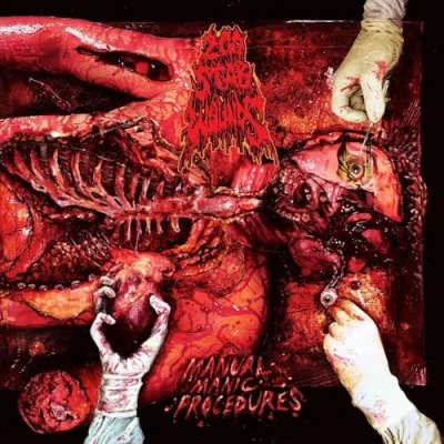 Abbildung von Manual Manic Procedures