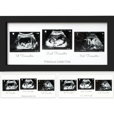 Abbildung von Trio Baby Bilderrahmen für Ultraschallbilder Ultraschallbild Baby, Ultraschall Schwangerschaft, Rahmen, Geschenke Werdende Mamas (Onyx Black)
